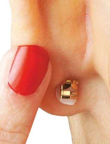 Accessoires - * | Lox